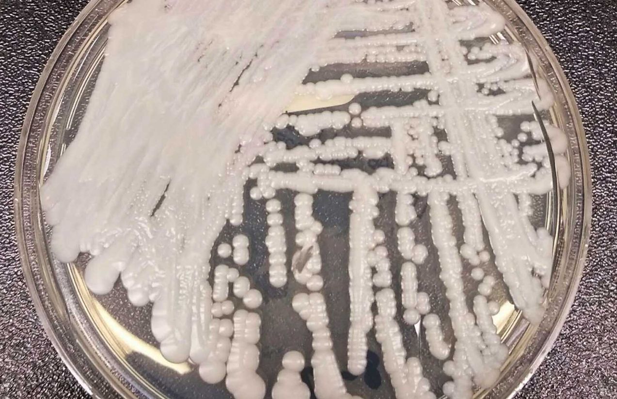 Health alert in the United States: Candida auris fungus spreads in hospitals in New York and New Jersey