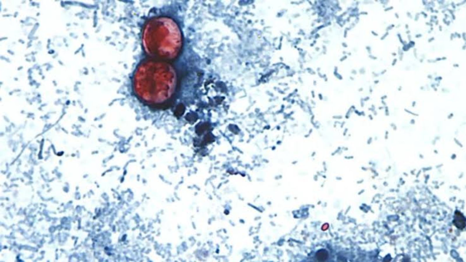 Cyclospora outbreak puts Michigan (United States) on alert after hundreds of people are affected Cyclospora outbreak puts Michigan (United States) on alert after hundreds of people are affected