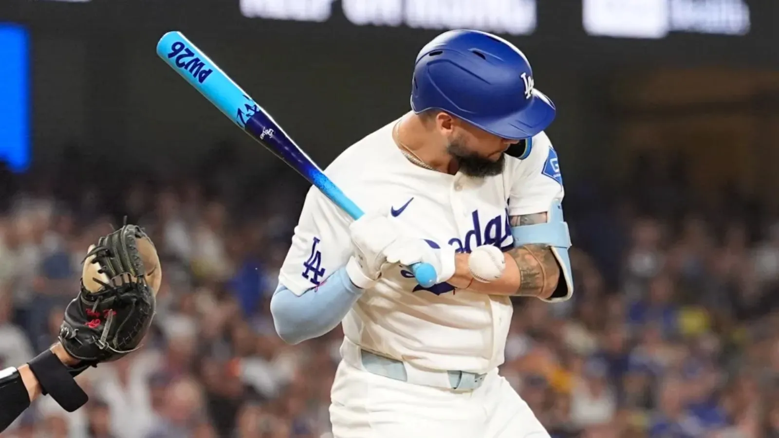 Andy Pagés suffers hand fracture, but Dodgers expect his return