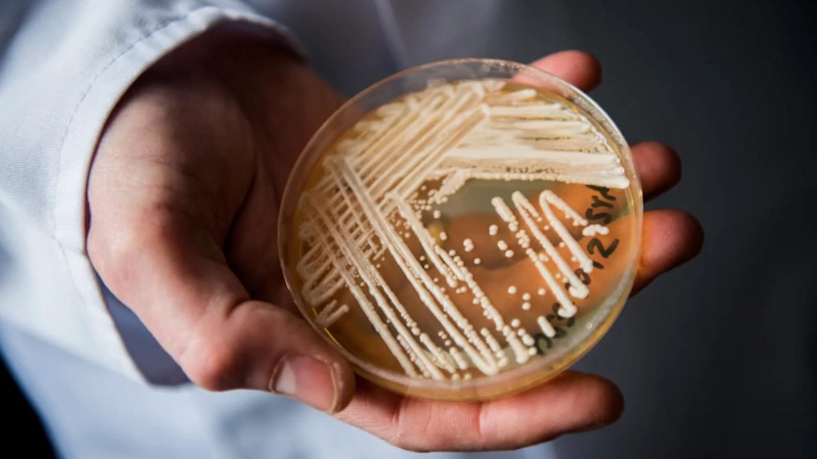 Candida auris spreads across the United States: More than 3,400 cases reported in 2026